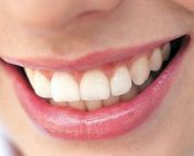 Healthy Teeth and Gums
